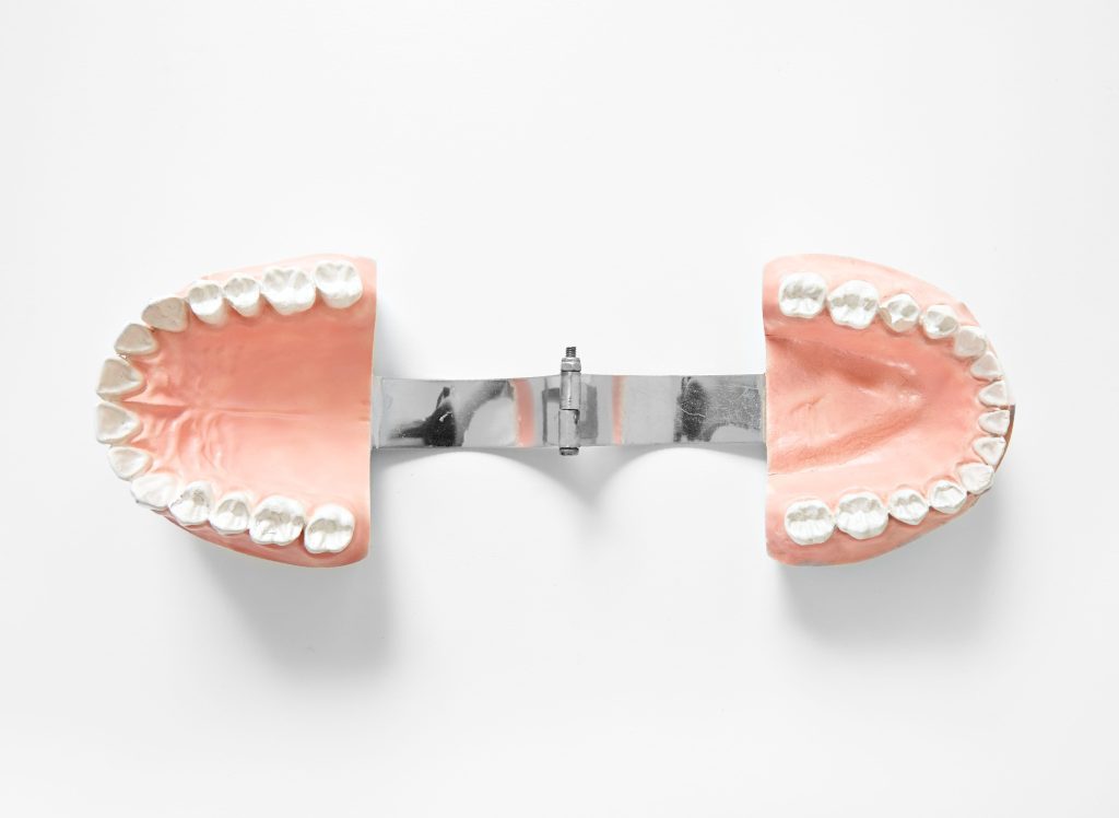 How MARPE Expands Jaws to Fix Crossbites, Crowding & Breathing Issues